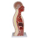 Erler-Zimmer NG & Tracheostomie Torso, lebensgroß