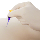 Histoacryl Gewebekleber blau 0,5 ml, 5 Ampullen